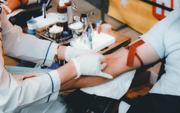 On the state of hemomicrocirculation in the aerobic wound infection