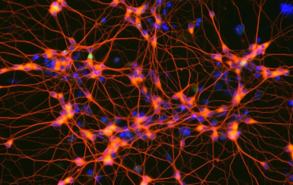 Emergent phase transitions in fully coupled multilayer neural networks based on quantum bifurcation processes